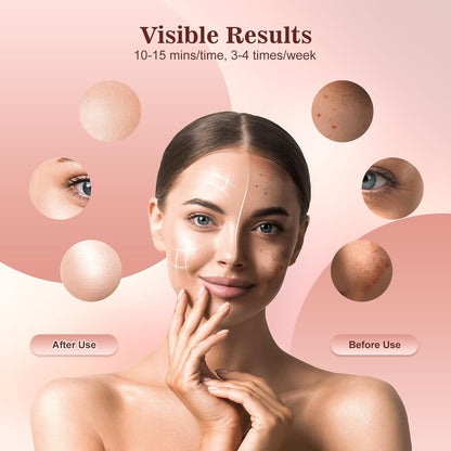 INTEO Red Light Therapy Face Mask - 3 Modes, Portable LED